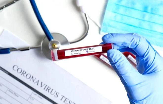 Cistus Creticus bitkisi koronavirüsten koruyor! 10 dakikalık temas, ölümcül virüsü etkisiz hale getirmek için yetiyor